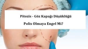 Pitozis – Göz Kapağı Düşüklüğü Polis Olmaya Engel Mi?