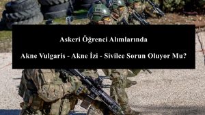 Askeri Öğrenci Alımlarında Akne Vulgaris – Akne İzi – Sivilce Sorun Oluyor Mu?
